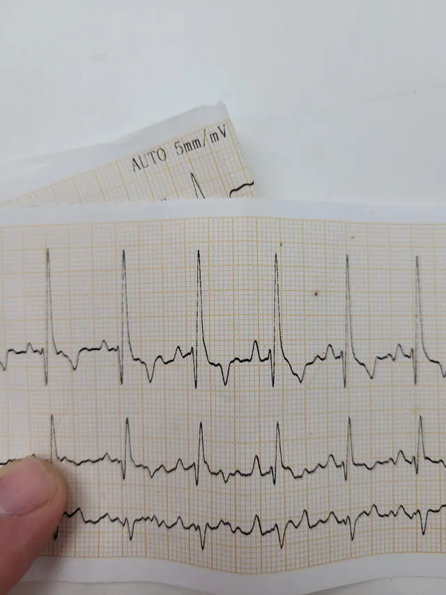 Imagen de Electrocardiograma