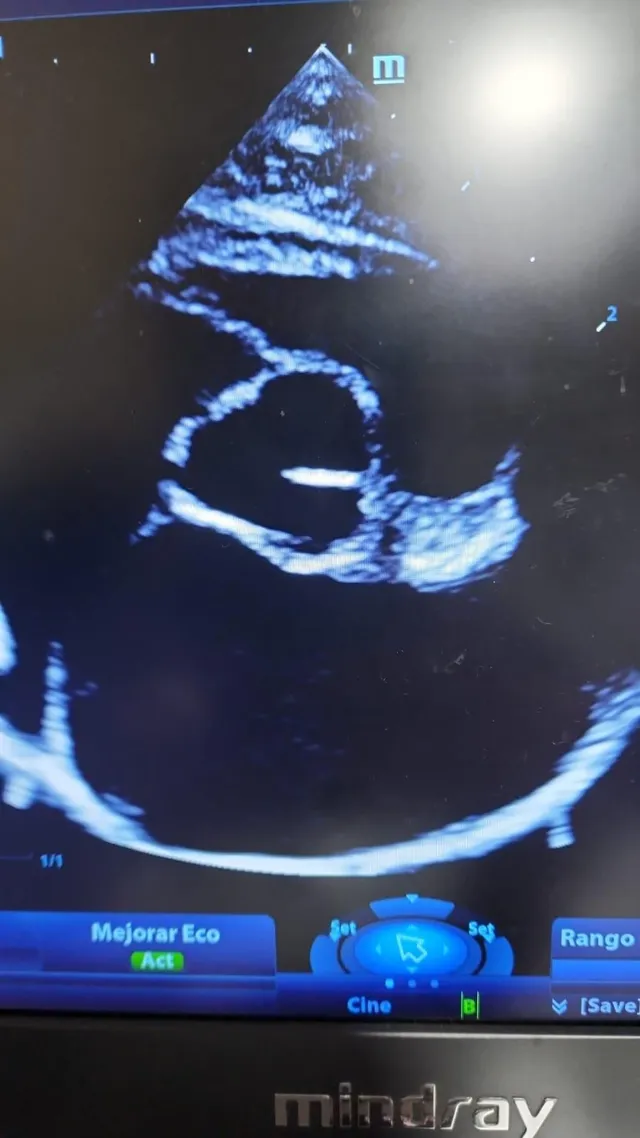 Imagen de Estudio cardiológico completo